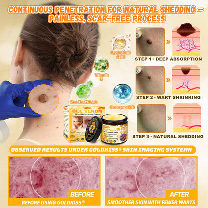 𝑮𝑶𝑳𝑫𝑲𝑰𝑺𝑺® 𝐁𝐄𝐄 𝐕𝐄𝐍𝐎𝐌 𝐏𝐑𝐎 𝐒𝐤𝐢𝐧 𝐑𝐞𝐬𝐭𝐨𝐫𝐚𝐭𝐢𝐨𝐧 𝐂𝐫𝐞𝐚𝐦 (Effective Within 7 Days)Bee Venom + 𝗣𝗿𝗼𝗽𝗼𝗹𝗶𝘀 · 7X Deep Hydration, targets wrinkles, sagging, stretch marks, dark spots, purpura, inflammations and more