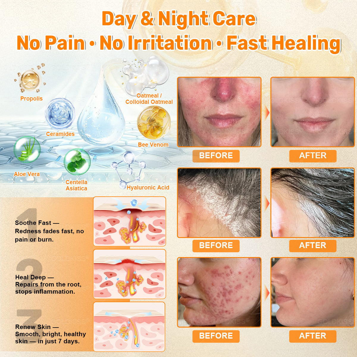 𝑮𝑶𝑳𝑫𝑲𝑰𝑺𝑺® 𝐁𝐄𝐄 𝐕𝐄𝐍𝐎𝐌 𝐏𝐑𝐎 𝐒𝐤𝐢𝐧 𝐑𝐞𝐬𝐭𝐨𝐫𝐚𝐭𝐢𝐨𝐧 𝐂𝐫𝐞𝐚𝐦 (Effective Within 7 Days)Bee Venom + 𝗣𝗿𝗼𝗽𝗼𝗹𝗶𝘀 · 7X Deep Hydration, targets wrinkles, sagging, stretch marks, dark spots, purpura, inflammations and more