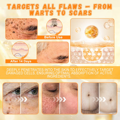 𝑮𝑶𝑳𝑫𝑲𝑰𝑺𝑺® 𝐁𝐄𝐄 𝐕𝐄𝐍𝐎𝐌 𝐏𝐑𝐎 𝐒𝐤𝐢𝐧 𝐑𝐞𝐬𝐭𝐨𝐫𝐚𝐭𝐢𝐨𝐧 𝐂𝐫𝐞𝐚𝐦 (Effective Within 7 Days)Bee Venom + 𝗣𝗿𝗼𝗽𝗼𝗹𝗶𝘀 · 7X Deep Hydration, targets wrinkles, sagging, stretch marks, dark spots, purpura, inflammations and more