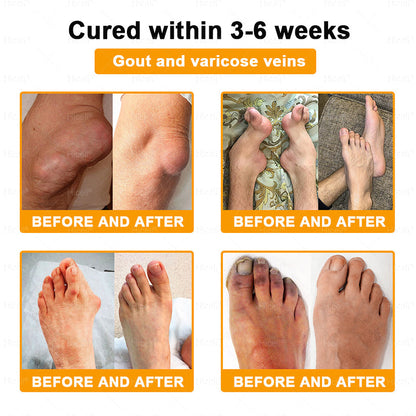 𝙃𝒊𝒄𝒆𝒍𝒍®🎁 Only 5 boxes left! We're offering you an additional 30% discount! Get yourself in shape and healthy. Miss out now, and you won't have another chance until next year.