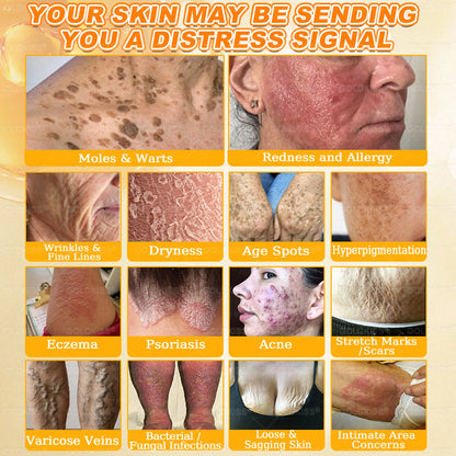 𝑮𝑶𝑳𝑫𝑲𝑰𝑺𝑺® 𝐁𝐄𝐄 𝐕𝐄𝐍𝐎𝐌 𝐏𝐑𝐎 𝐒𝐤𝐢𝐧 𝐑𝐞𝐬𝐭𝐨𝐫𝐚𝐭𝐢𝐨𝐧 𝐂𝐫𝐞𝐚𝐦 (Effective Within 7 Days)Bee Venom + 𝗣𝗿𝗼𝗽𝗼𝗹𝗶𝘀 · 7X Deep Hydration, targets wrinkles, sagging, stretch marks, dark spots, purpura, inflammations and more