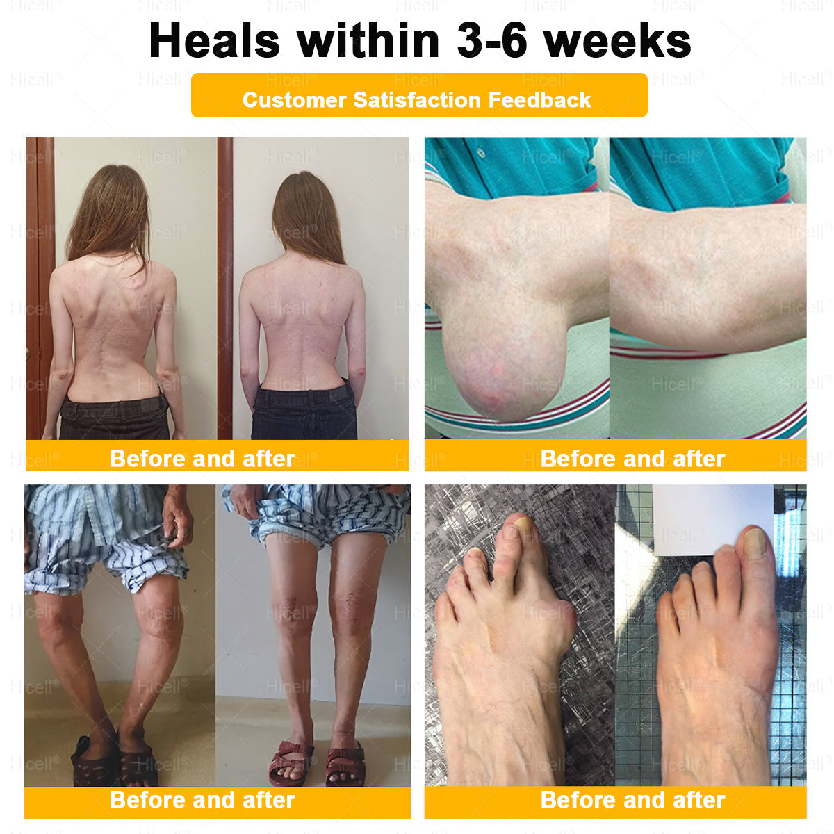 𝙃𝒊𝒄𝒆𝒍𝒍®🎁 Only 5 boxes left! We're offering you an additional 30% discount! Get yourself in shape and healthy. Miss out now, and you won't have another chance until next year.