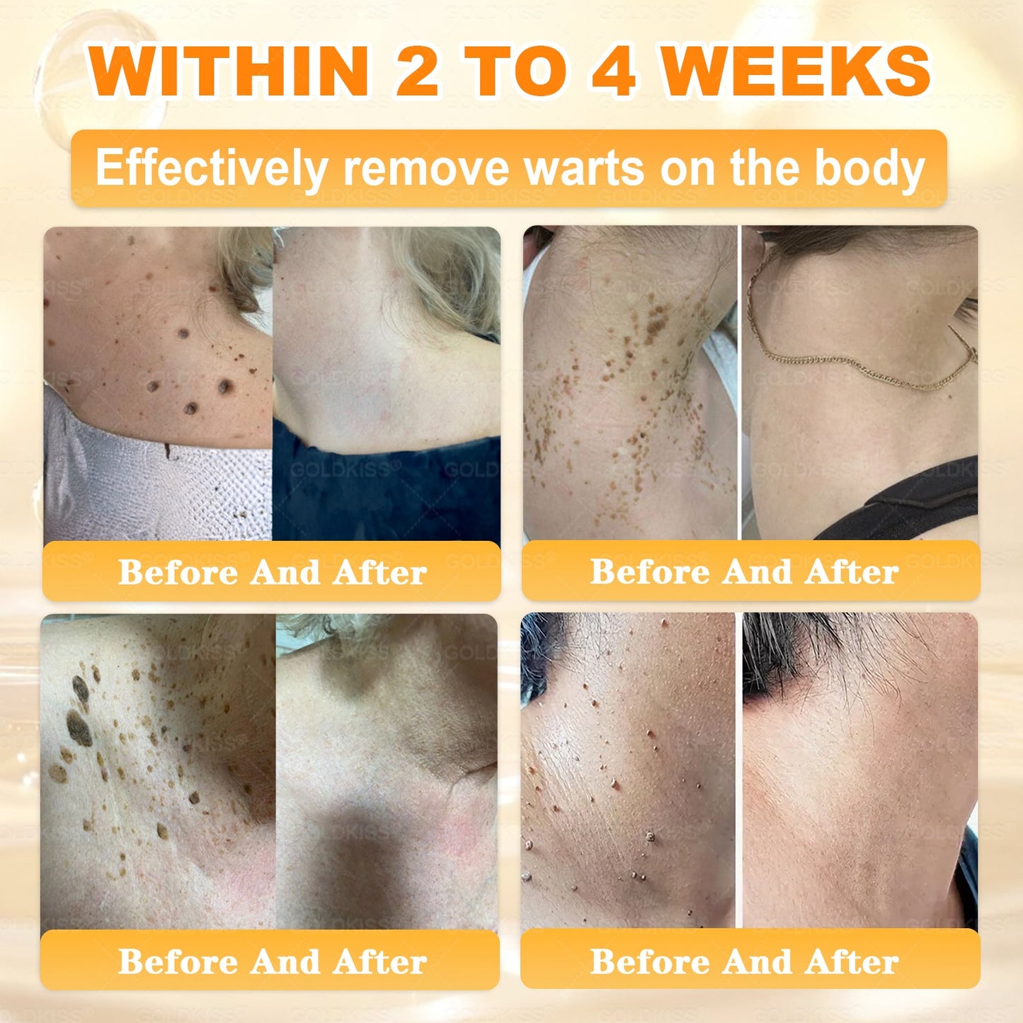 𝑮𝑶𝑳𝑫𝑲𝑰𝑺𝑺® 𝐁𝐄𝐄 𝐕𝐄𝐍𝐎𝐌 𝐏𝐑𝐎 𝐒𝐤𝐢𝐧 𝐑𝐞𝐬𝐭𝐨𝐫𝐚𝐭𝐢𝐨𝐧 𝐂𝐫𝐞𝐚𝐦 (Effective Within 7 Days)Bee Venom + 𝗣𝗿𝗼𝗽𝗼𝗹𝗶𝘀 · 7X Deep Hydration, targets wrinkles, sagging, stretch marks, dark spots, purpura, inflammations and more