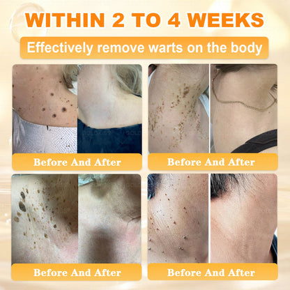 𝑮𝑶𝑳𝑫𝑲𝑰𝑺𝑺® 𝐁𝐄𝐄 𝐕𝐄𝐍𝐎𝐌 𝐏𝐑𝐎 𝐒𝐤𝐢𝐧 𝐑𝐞𝐬𝐭𝐨𝐫𝐚𝐭𝐢𝐨𝐧 𝐂𝐫𝐞𝐚𝐦 (Effective Within 7 Days)Bee Venom + 𝗣𝗿𝗼𝗽𝗼𝗹𝗶𝘀 · 7X Deep Hydration, targets wrinkles, sagging, stretch marks, dark spots, purpura, inflammations and more