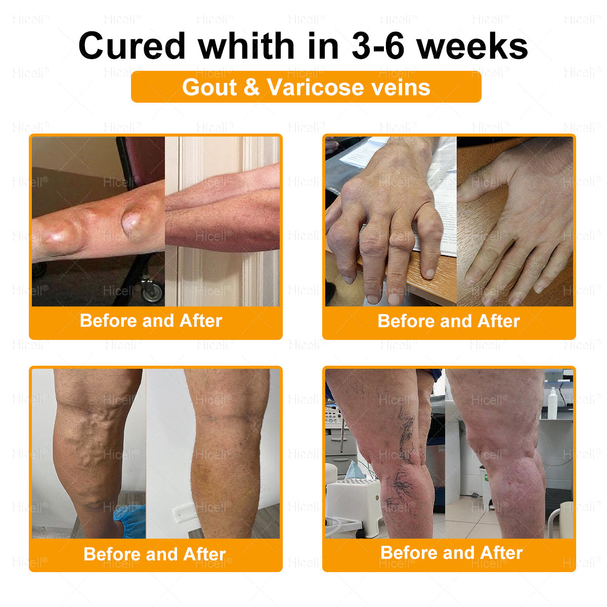 𝙃𝒊𝒄𝒆𝒍𝒍®🎁 Only 5 boxes left! We're offering you an additional 30% discount! Get yourself in shape and healthy. Miss out now, and you won't have another chance until next year.