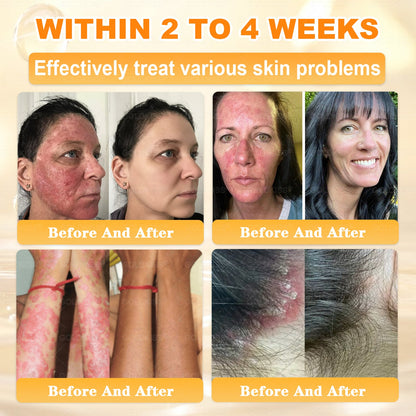 𝑮𝑶𝑳𝑫𝑲𝑰𝑺𝑺® 𝐁𝐄𝐄 𝐕𝐄𝐍𝐎𝐌 𝐏𝐑𝐎 𝐒𝐤𝐢𝐧 𝐑𝐞𝐬𝐭𝐨𝐫𝐚𝐭𝐢𝐨𝐧 𝐂𝐫𝐞𝐚𝐦 (Effective Within 7 Days)Bee Venom + 𝗣𝗿𝗼𝗽𝗼𝗹𝗶𝘀 · 7X Deep Hydration, targets wrinkles, sagging, stretch marks, dark spots, purpura, inflammations and more