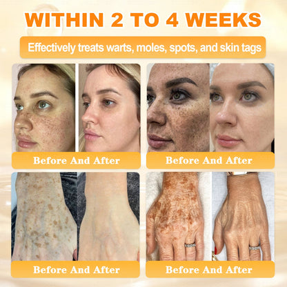 𝑮𝑶𝑳𝑫𝑲𝑰𝑺𝑺® 𝐁𝐄𝐄 𝐕𝐄𝐍𝐎𝐌 𝐏𝐑𝐎 𝐒𝐤𝐢𝐧 𝐑𝐞𝐬𝐭𝐨𝐫𝐚𝐭𝐢𝐨𝐧 𝐂𝐫𝐞𝐚𝐦 (Effective Within 7 Days)Bee Venom + 𝗣𝗿𝗼𝗽𝗼𝗹𝗶𝘀 · 7X Deep Hydration, targets wrinkles, sagging, stretch marks, dark spots, purpura, inflammations and more