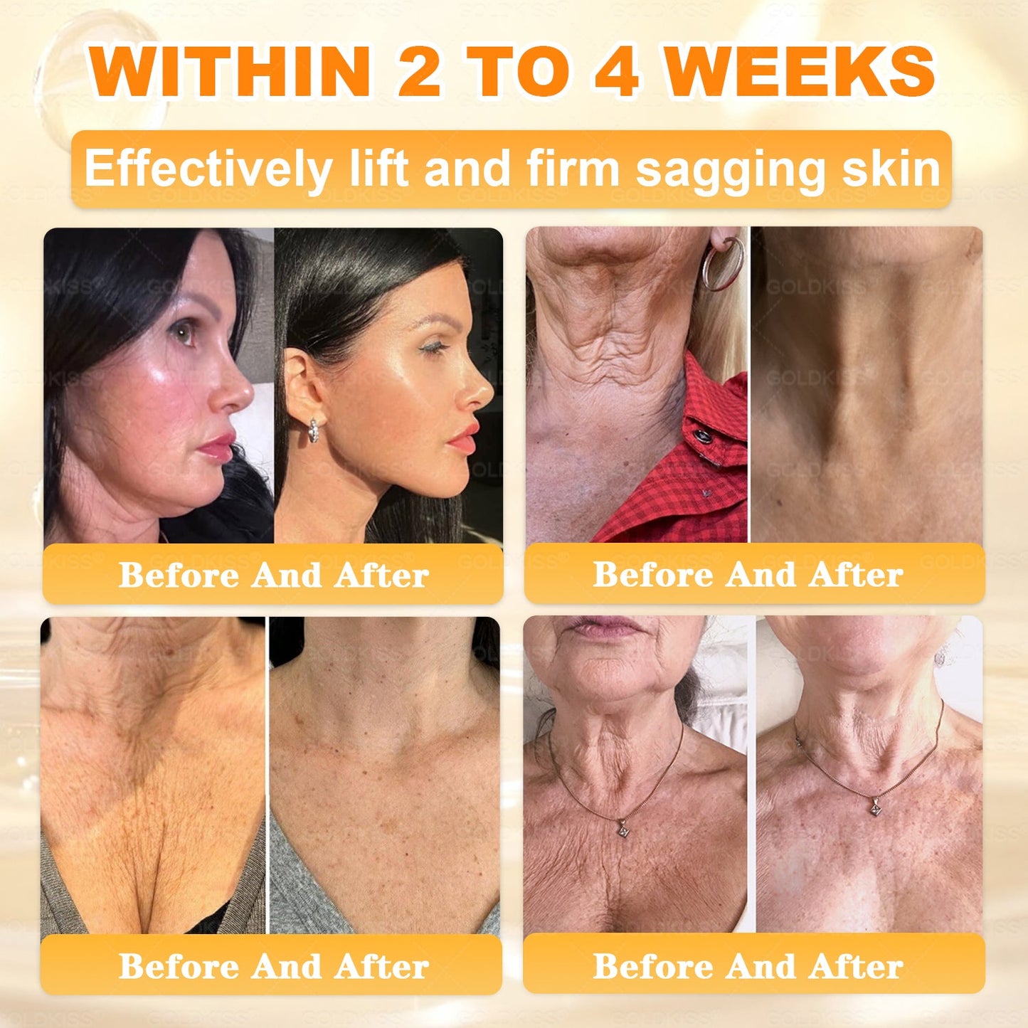 𝑮𝑶𝑳𝑫𝑲𝑰𝑺𝑺® 𝐁𝐄𝐄 𝐕𝐄𝐍𝐎𝐌 𝐏𝐑𝐎 𝐒𝐤𝐢𝐧 𝐑𝐞𝐬𝐭𝐨𝐫𝐚𝐭𝐢𝐨𝐧 𝐂𝐫𝐞𝐚𝐦 (Effective Within 7 Days)Bee Venom + 𝗣𝗿𝗼𝗽𝗼𝗹𝗶𝘀 · 7X Deep Hydration, targets wrinkles, sagging, stretch marks, dark spots, purpura, inflammations and more