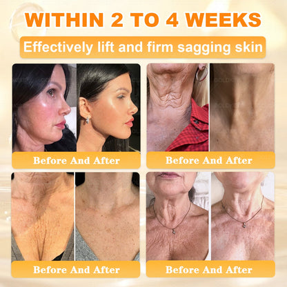 𝑮𝑶𝑳𝑫𝑲𝑰𝑺𝑺® 𝐁𝐄𝐄 𝐕𝐄𝐍𝐎𝐌 𝐏𝐑𝐎 𝐒𝐤𝐢𝐧 𝐑𝐞𝐬𝐭𝐨𝐫𝐚𝐭𝐢𝐨𝐧 𝐂𝐫𝐞𝐚𝐦 (Effective Within 7 Days)Bee Venom + 𝗣𝗿𝗼𝗽𝗼𝗹𝗶𝘀 · 7X Deep Hydration, targets wrinkles, sagging, stretch marks, dark spots, purpura, inflammations and more