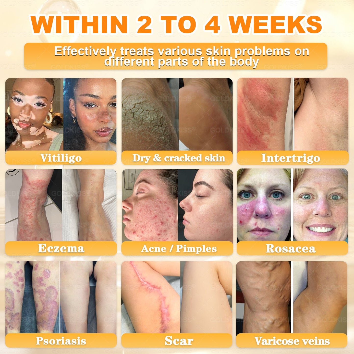 𝑮𝑶𝑳𝑫𝑲𝑰𝑺𝑺® 𝐁𝐄𝐄 𝐕𝐄𝐍𝐎𝐌 𝐏𝐑𝐎 𝐒𝐤𝐢𝐧 𝐑𝐞𝐬𝐭𝐨𝐫𝐚𝐭𝐢𝐨𝐧 𝐂𝐫𝐞𝐚𝐦 (Effective Within 7 Days)Bee Venom + 𝗣𝗿𝗼𝗽𝗼𝗹𝗶𝘀 · 7X Deep Hydration, targets wrinkles, sagging, stretch marks, dark spots, purpura, inflammations and more